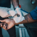 Why You Need A Houston Burn Injury Lawyer After A Serious Accident