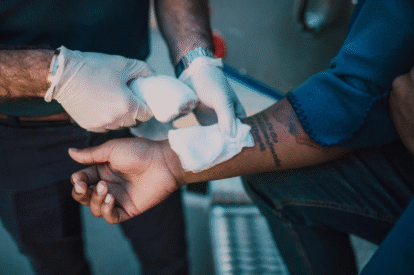 Why You Need A Houston Burn Injury Lawyer After A Serious Accident