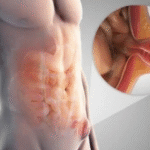 Top Hernia Surgeon in Dubai and General Surgeon in Dubai for Safe and Advanced Procedures