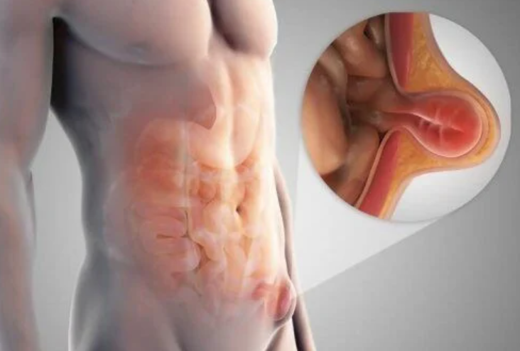 Top Hernia Surgeon in Dubai and General Surgeon in Dubai for Safe and Advanced Procedures