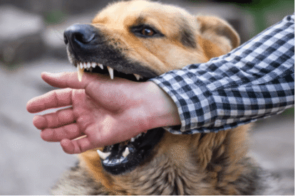 Child Suffers a Dog Bite